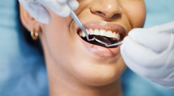 Best Broken or Cracked Tooth Emergency Dentist in New Egypt, NJ