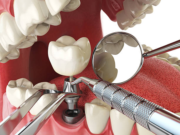 Best Emergency Dental Extractions in New Egypt, NJ